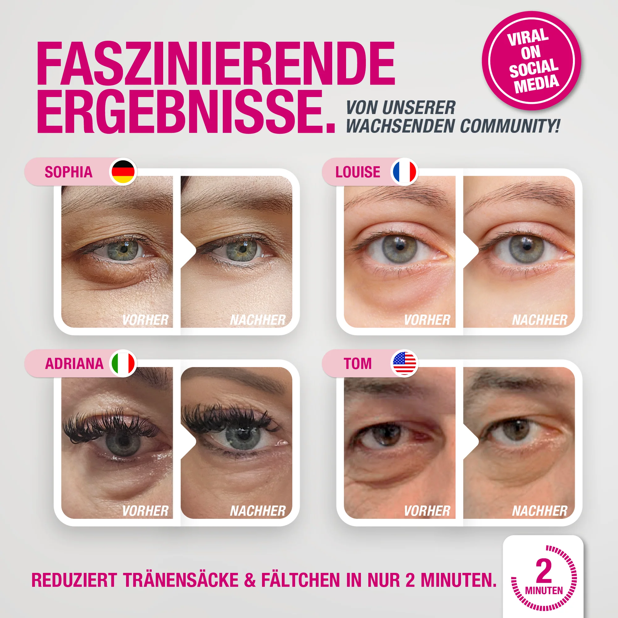EYEBAGHACK - Express Eyelift Effect - Image 5