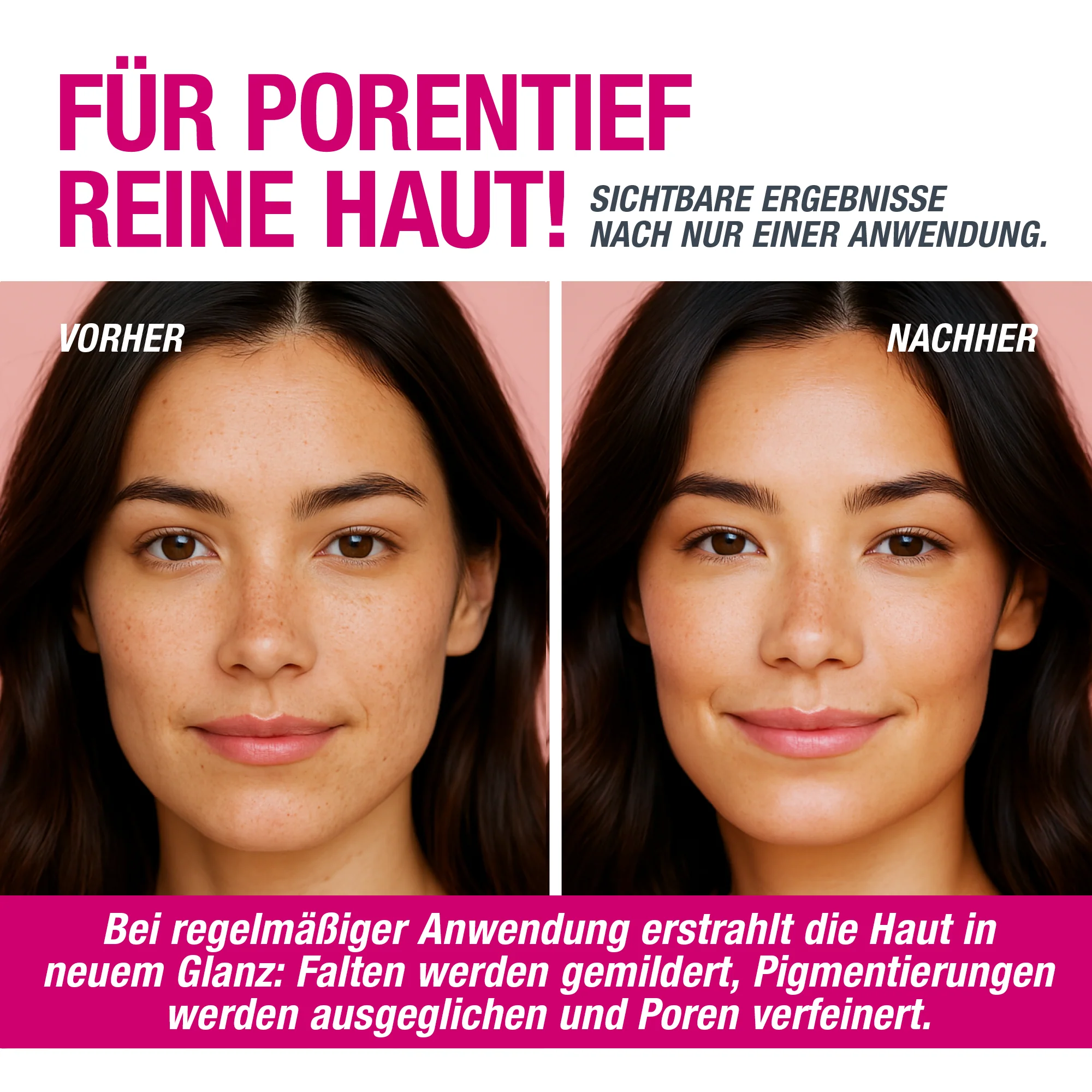VAMPIRE PEEL® - Fruchtsäurepeeling - Image 4